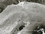 5 - Sezione longitudinale radiale con porzione dell'ipotallo a struttura coassiale